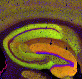 Image of hippocampus region of the brain