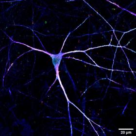 A microscope image of a single neuron