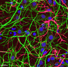 confocal image of cultured neurones and glia